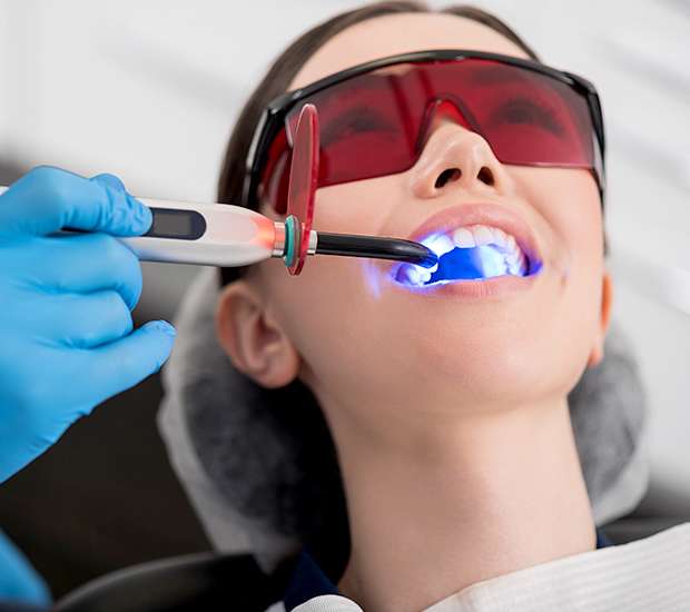 Lewisburg Professional Teeth Whitening
