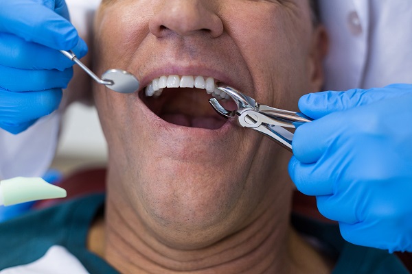 Why You Should Rest After A Tooth Extraction